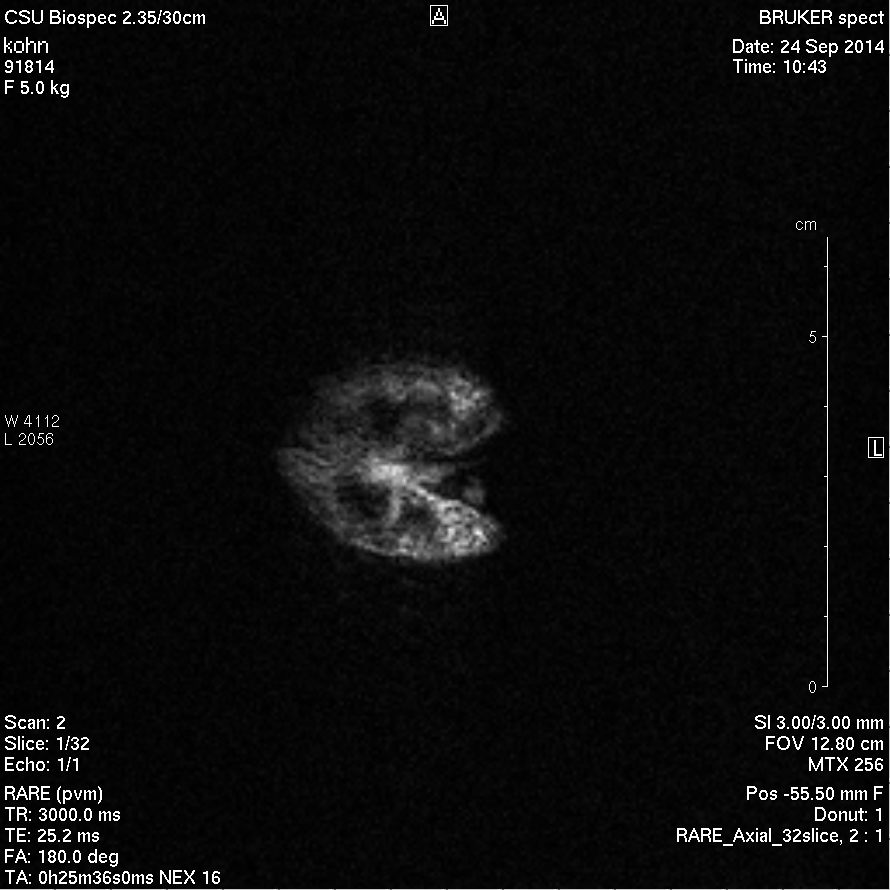 MRI of glazed doughnut taken with axial slices