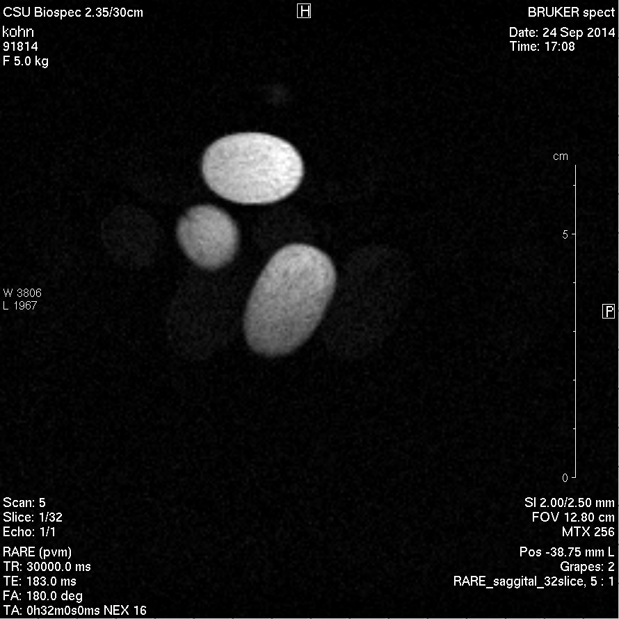 MRI of grapes taken with sagittal slices